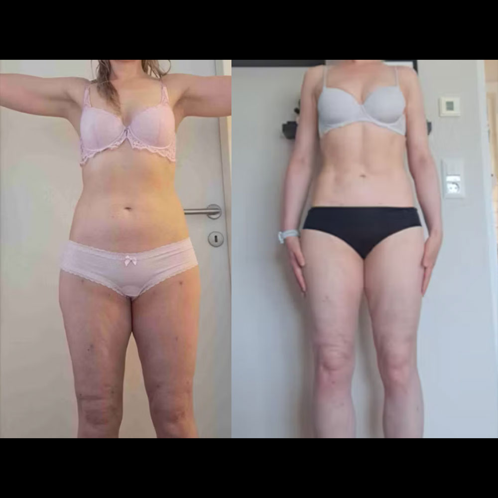 Transformation 1