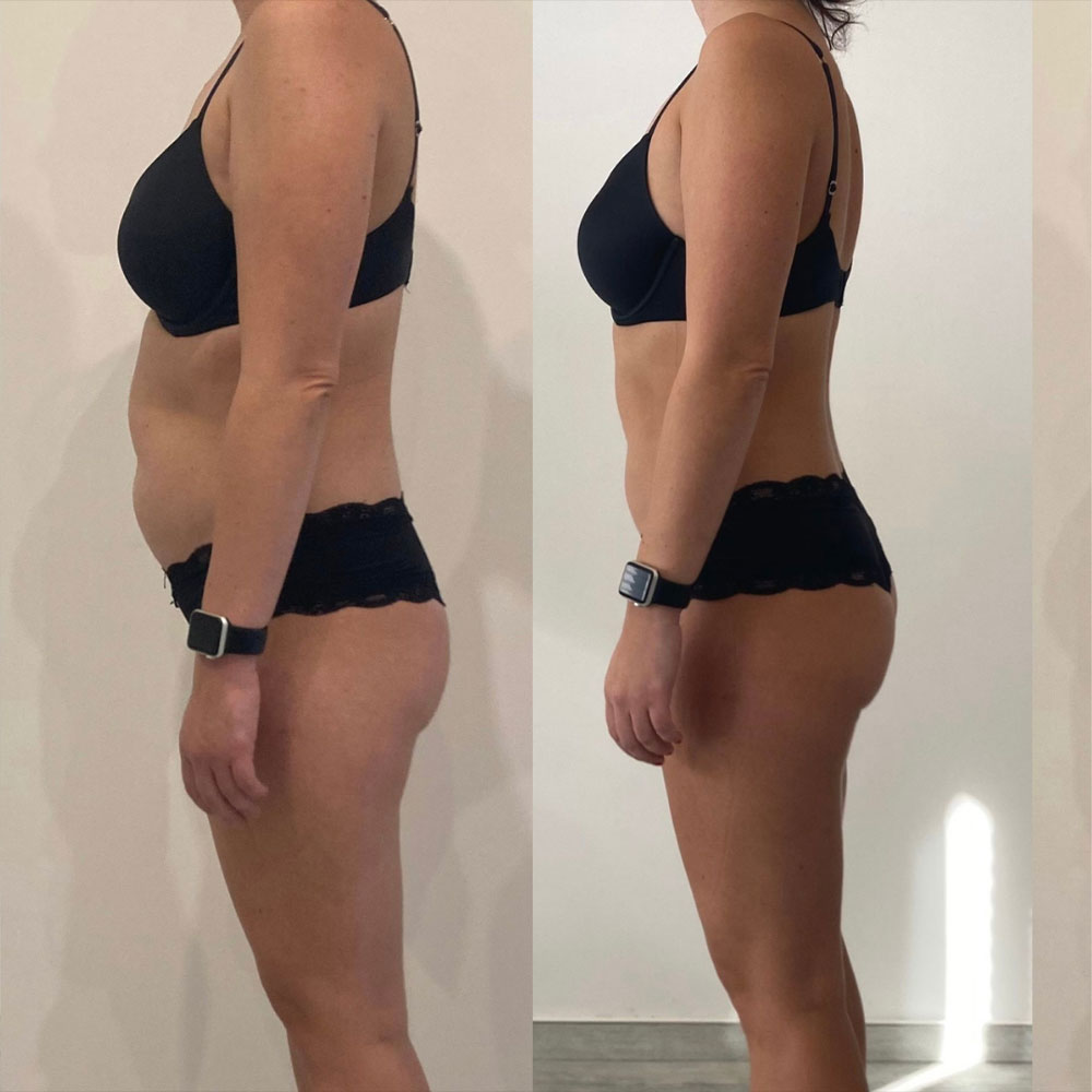 Transformation 2